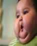 حدود 30 درصد کودکان به اضافه وزن و چاقي مبتلا هستند
