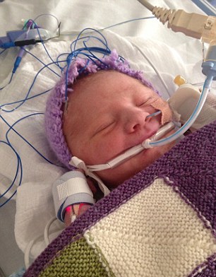 نوزاد تازه بدنیا آمده پس از مرگ دوباره زنده شد+ تصاویر