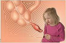 دل درد کودک همراه با تب