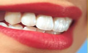  ابداع روشی نوین برای پیشگیری از پوسیدگی دندان
