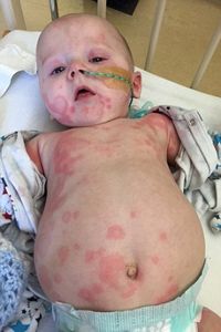 تولد نوزادی با بیماری نادر + تصاویر