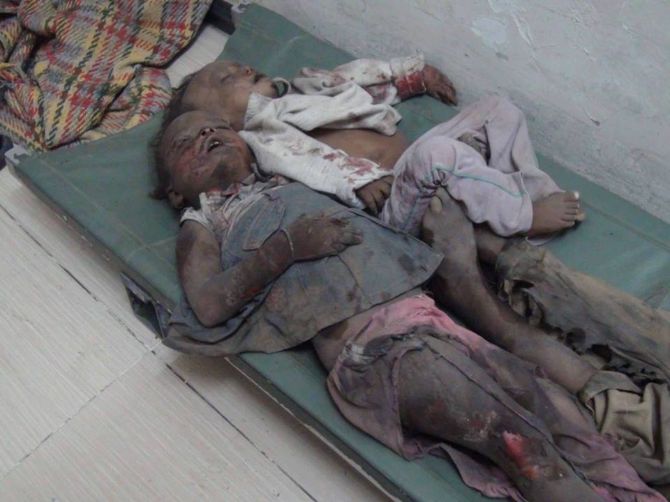 تصاویر هولناک از پیکر کودکان یمنی