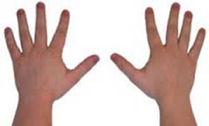 علت صدای شکستن بند انگشتان چیست؟ 1