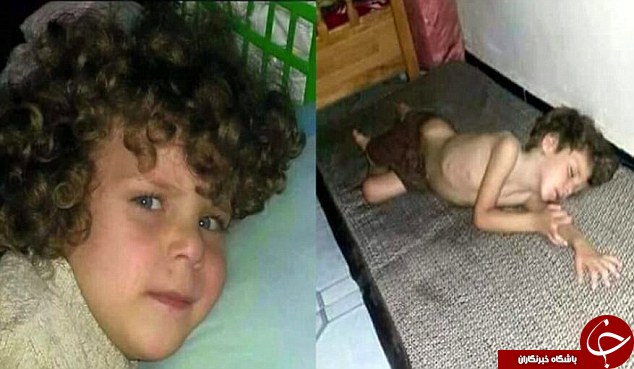 تصاویر تکان دهنده قبل و بعد کودکان سوری