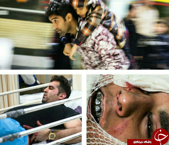 برخورد نارنجک به صورت مامور نیرو انتظامی پایتخت/اولین قربانی چهارشنبه سوری در رباط کریم جان سپرد+تصاویر