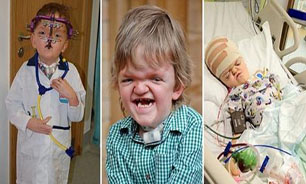 چهره‌ی جدید پسر خردسال به خاطر بیماری ژنتیکی + تصاویر 1