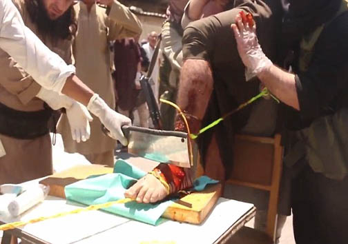 قطع دست و پا با ساطور داعشی+عکس