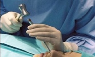 محسنی////////مرگ دختر ۲۱ ساله تهرانی هنگام عمل جراحی زیبایی