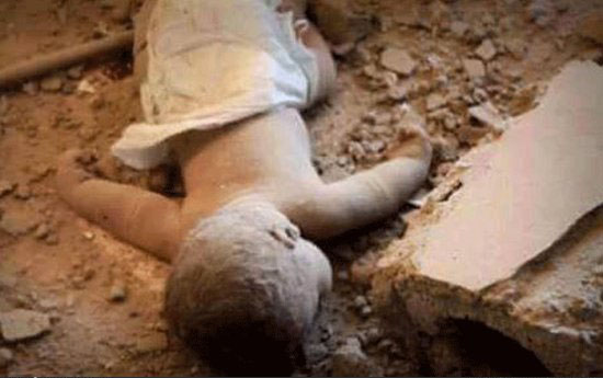 عکس تکان دهنده از شهادت کودک شیرخوار  یمنی