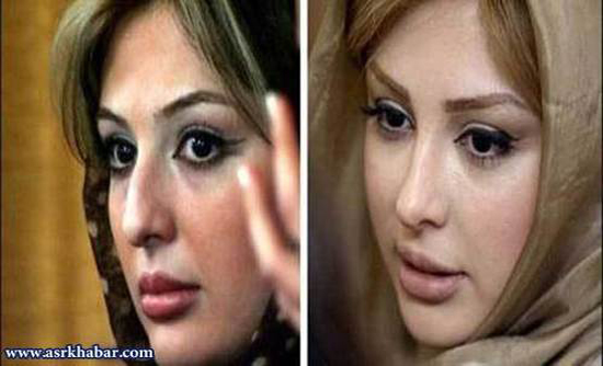تفاوت چهره بازیگران زن ایرانی، قبل و بعد از عمل زیبایی +تصاویر