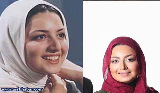 تفاوت چهره بازیگران زن ایرانی، قبل و بعد از عمل زیبایی +تصاویر