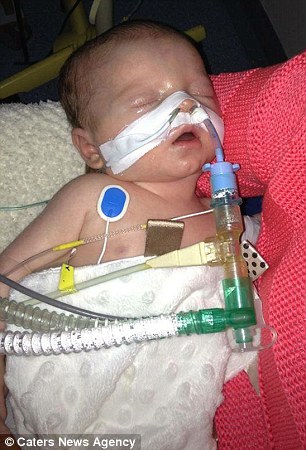 زنده شدن نوزاد مرگ مغزی پس از قطع دستگاه احیاکننده حیات + تصاویر