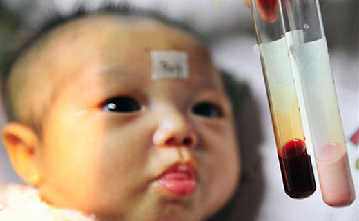 نوزادی که خونش صورتی رنگ است + عکس