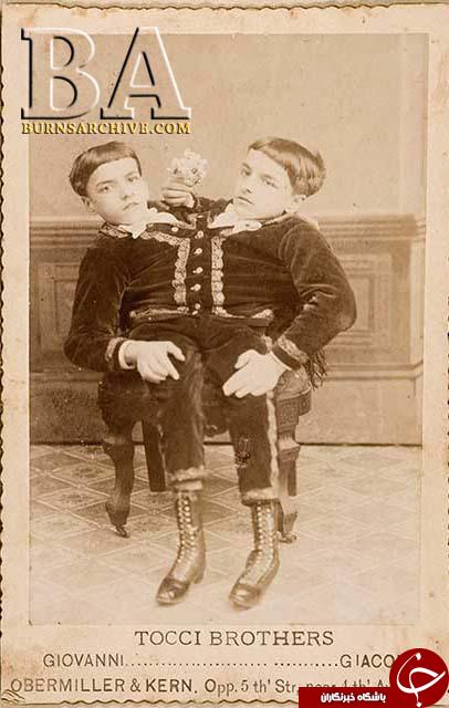 تصاویر عجیب دیده نشده از بازیگران سیرک در قرن 19