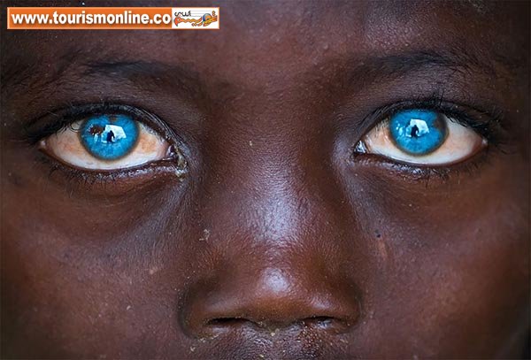 بیماری این پسر باعث شده زیباترین چشم‌های جهان را داشته باشد! +تصاویر