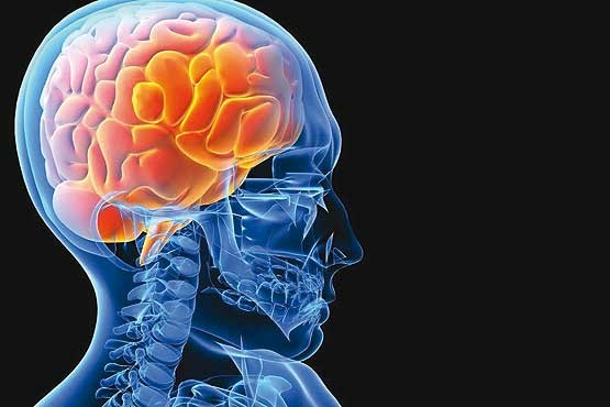 بلوغ زودرس خطر ابتلا به سکته مغزی را افزایش می‌دهد/ استرس زنگ خطری برای بروز سکته مغزی