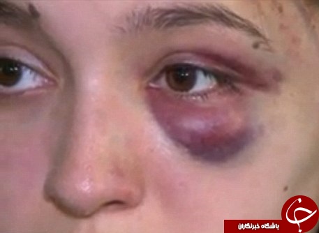 حمله وحشیانه اراذل به دختر نوجوان در روز روشن+تصاویر