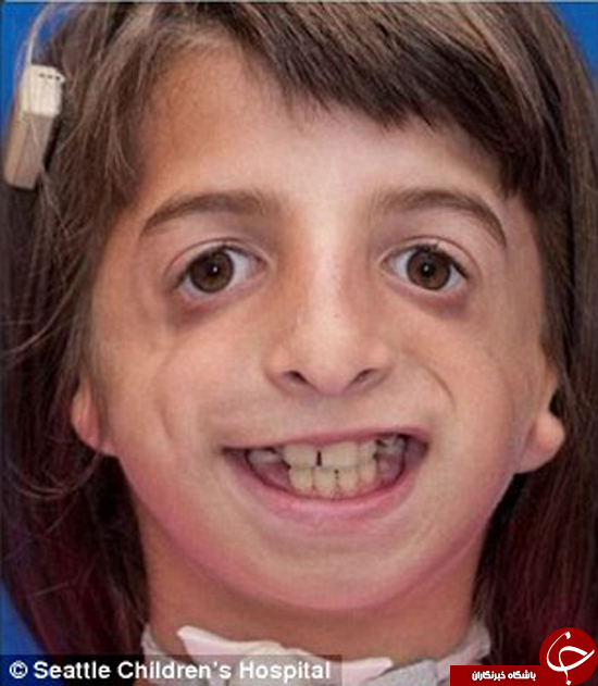 دختر 9 ساله بالاخره توانست بدون استفاده از لوله نفس بکشد +تصاویر