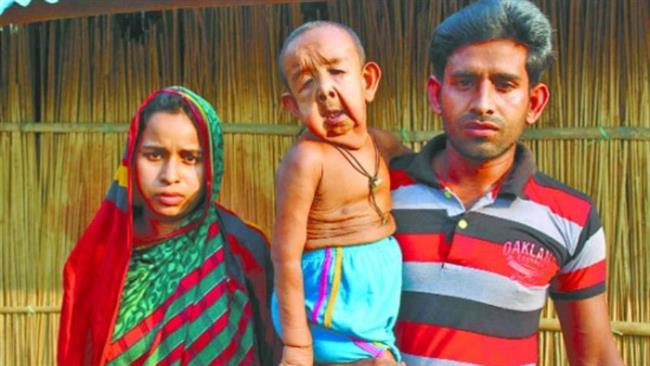 بیماری پیرمرد 4 ساله بنگلادشی به صورت رایگان بررسی می‌شود+ تصاویر