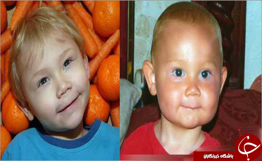 پسری که با خوردن هویج پوستش نارنجی می شود+عکس