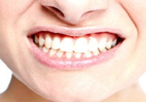 ۶ راهکار ساده برای داشتن دندان سفیدتر