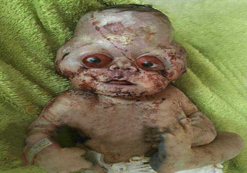 تولد نوزادی با چهره عجیب شایعه یا واقعیت + تصویر