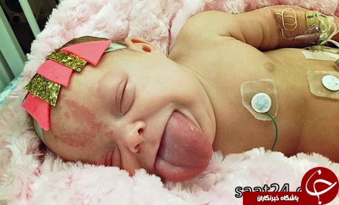 تصاویری از نوزاد زبان دراز که عاقبت خندید