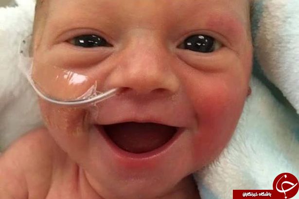 لبخند این نوزاد نارس توجه کاربران اینترنت را به خود جلب کرده است+ عکس