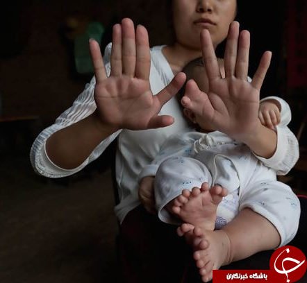 نوزاد عجیب کودک عجیب عجیب الخلقه اخبار چین آدم عجیب 6 انگشتی 12 انگشتی