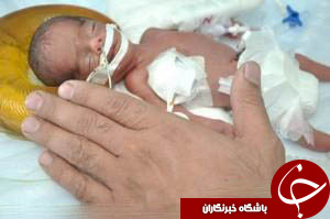 تولد نوزادی به اندازه کف دست+عکس