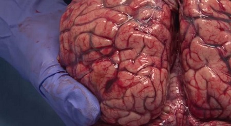 نمای متفاوت و جالب از مغز انسان + فیلم