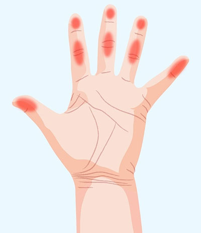 دست ها چه چیزهایی درباره سلامت ما می گویند