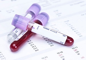 چگونه آزمايش خون بارداري را بخوانيم؟