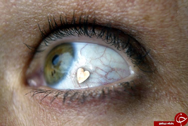 کلینیک‌های چشم‌پزشکی‌ که نور را از چشم لاکچری‌ها می‌گیرد