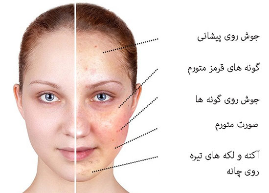 غذاهایی که پوست صورت را تغییر می دهند