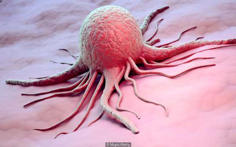 چطور سلول‌های سرطانی در نقاط مختلف بدن، تکثیر می‌شود؟