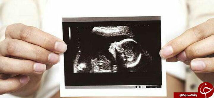 عکس عجیب جنین، موجب وحشت زن باردار جوان شد + تصاویر
