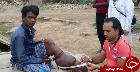  مادر هندی درمان بیماری هولناک پسرش را به جادوگران سپرد!+تصاویر