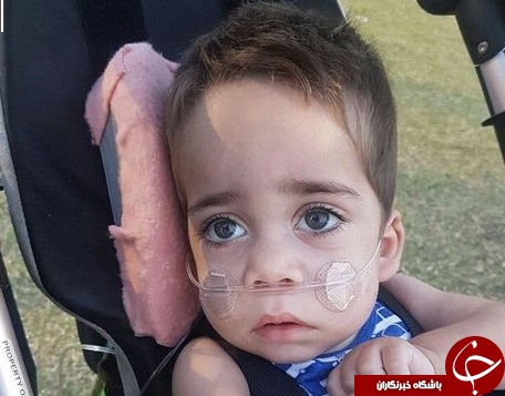 بیماری نادر کودک استرالیایی؛ او فقط ۳ سال زنده می‌ماند+ تصاویر