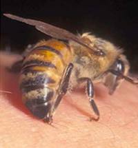 برداشتن سريع نيش زنبور از روي زخم ضروري است