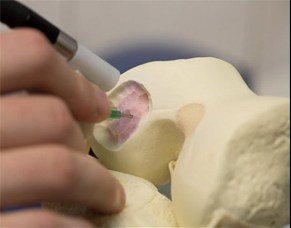 ساخت پودر مبدل عضله به استخوان از صفحه رشد جنین