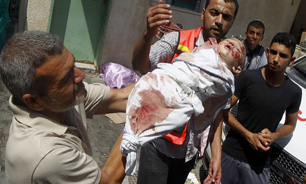 408 کودک کشته و 2502 کودک دیگر مجروح شده‌اند/ سلاح های مورد استفاده در غزه باعث قطع عضو و نقص عضو شده است