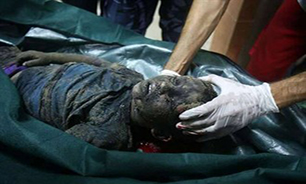 تصاویر دلخراش از شهدای فلسطینی که سوخته‌اند/ پیکرهای تکه‌تکه شده شهروندان غزه + فیلم (16+)