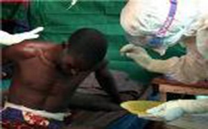 وضعیت تأثربار بیماران مبتلا به ابولا، پس از درمان!