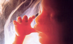 خطر سقط جنین در سه ماهه اول بارداری