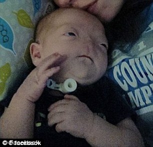 نوزادی که بدون بینی متولد شد + عکس