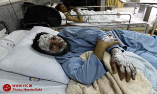 عیادت وزیر بهداشت از مجروحان یمنی