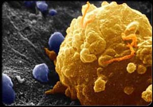 رصد رفتار سلول‌های سرطانی به کمک اکسید گرافن