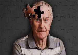 5 دلیل عجیب بیماری آلزایمر