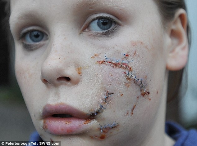 حمله خونین دختر جوان به سرآشپز بخاطر غذای گران/سگ وحشی صورت دختر 12 ساله را تکه تکه کرد+ تصاویر